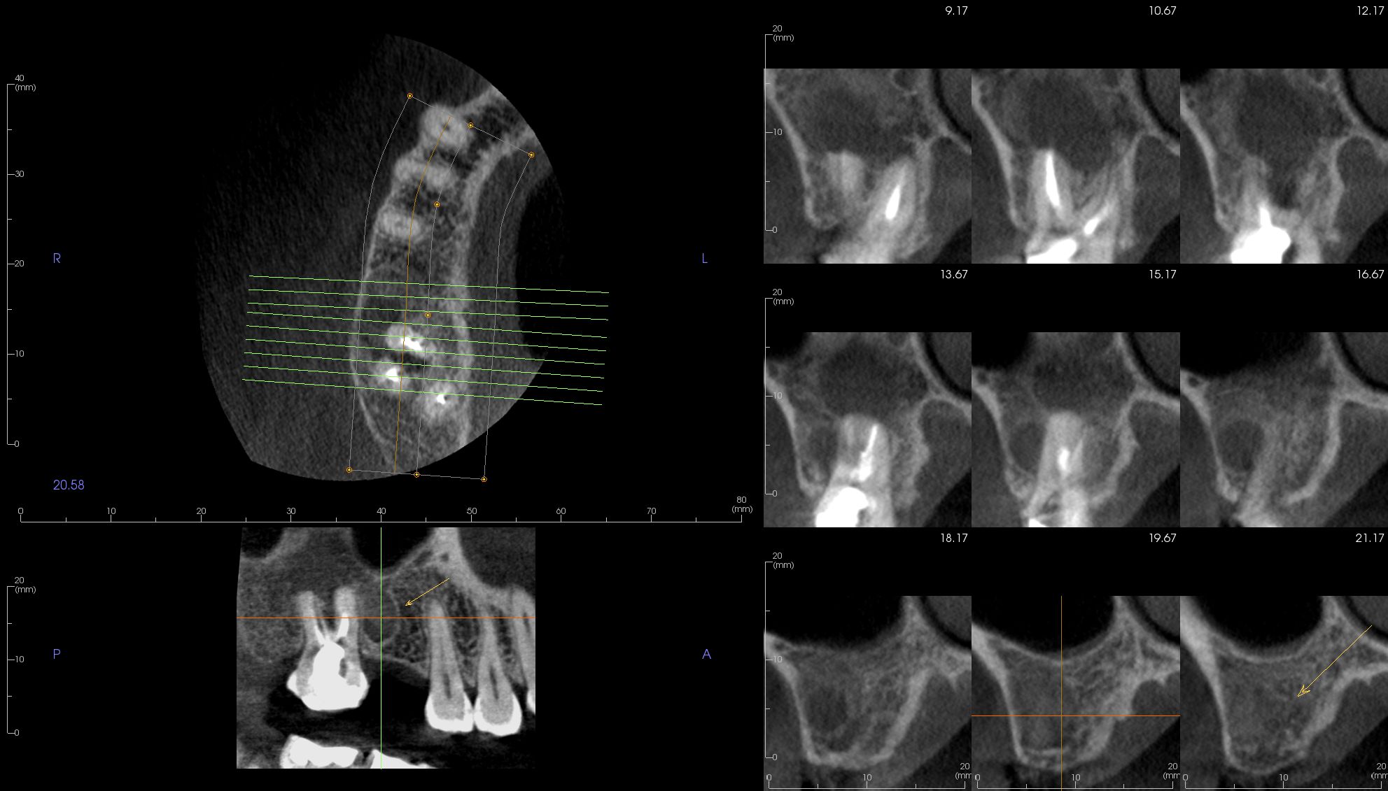 case-3.2-ArchSection_2