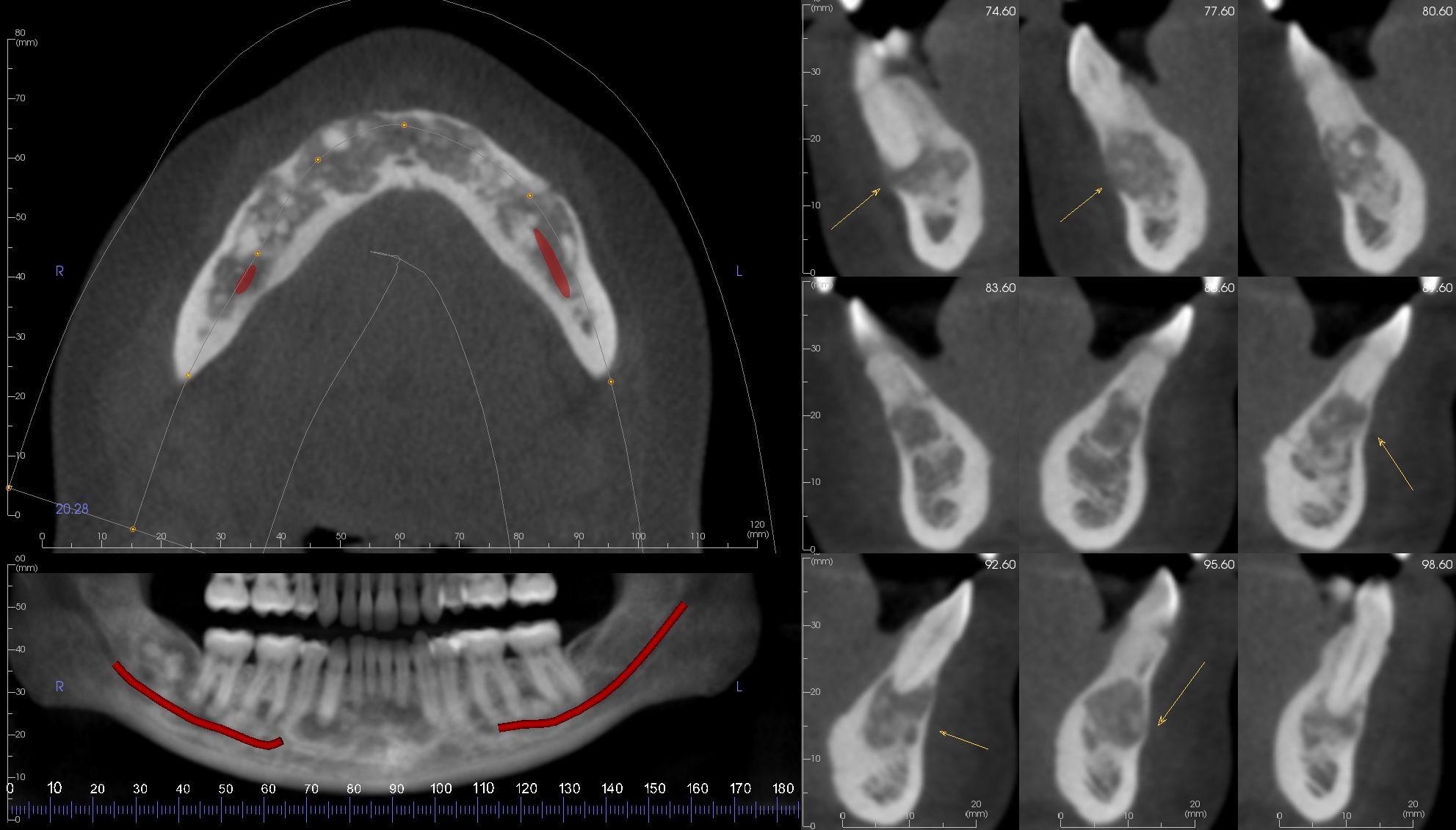 case-4.3-ArchSection_3