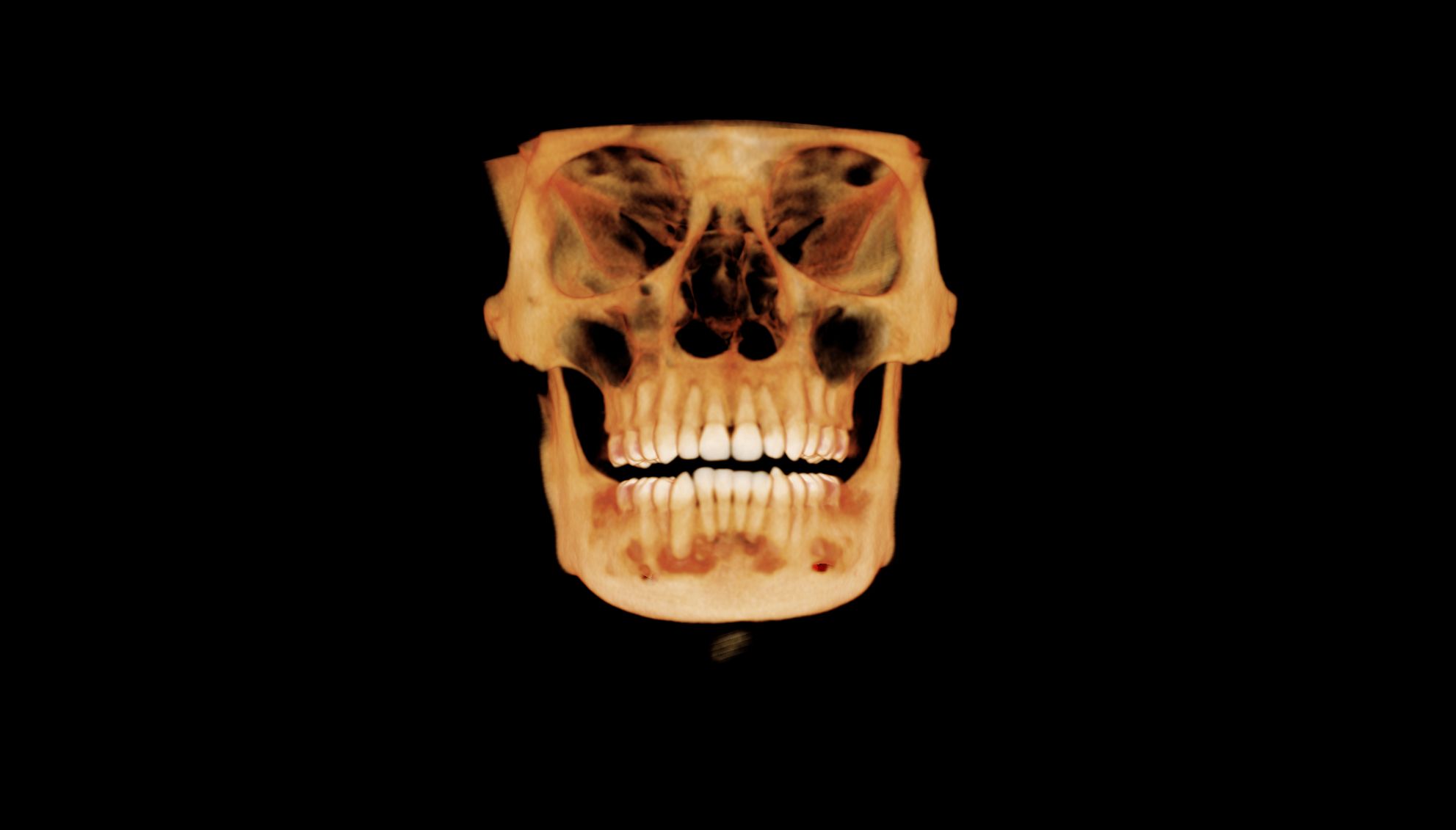 case-4.4-3D_Volume_4