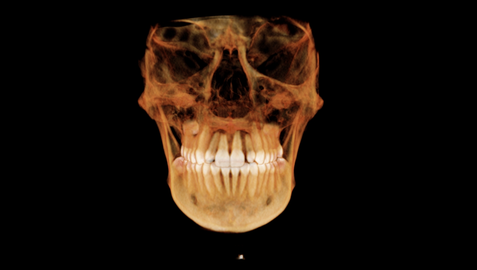 3D model-frontal view