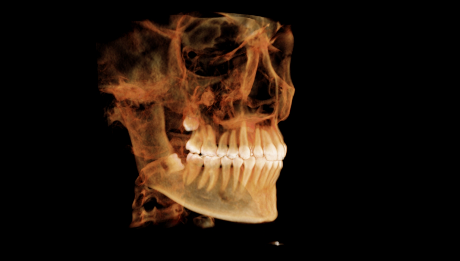 3d model-parasagittal view